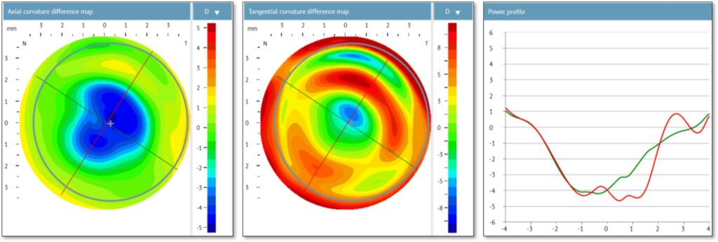 ESP Ortho Difference maps